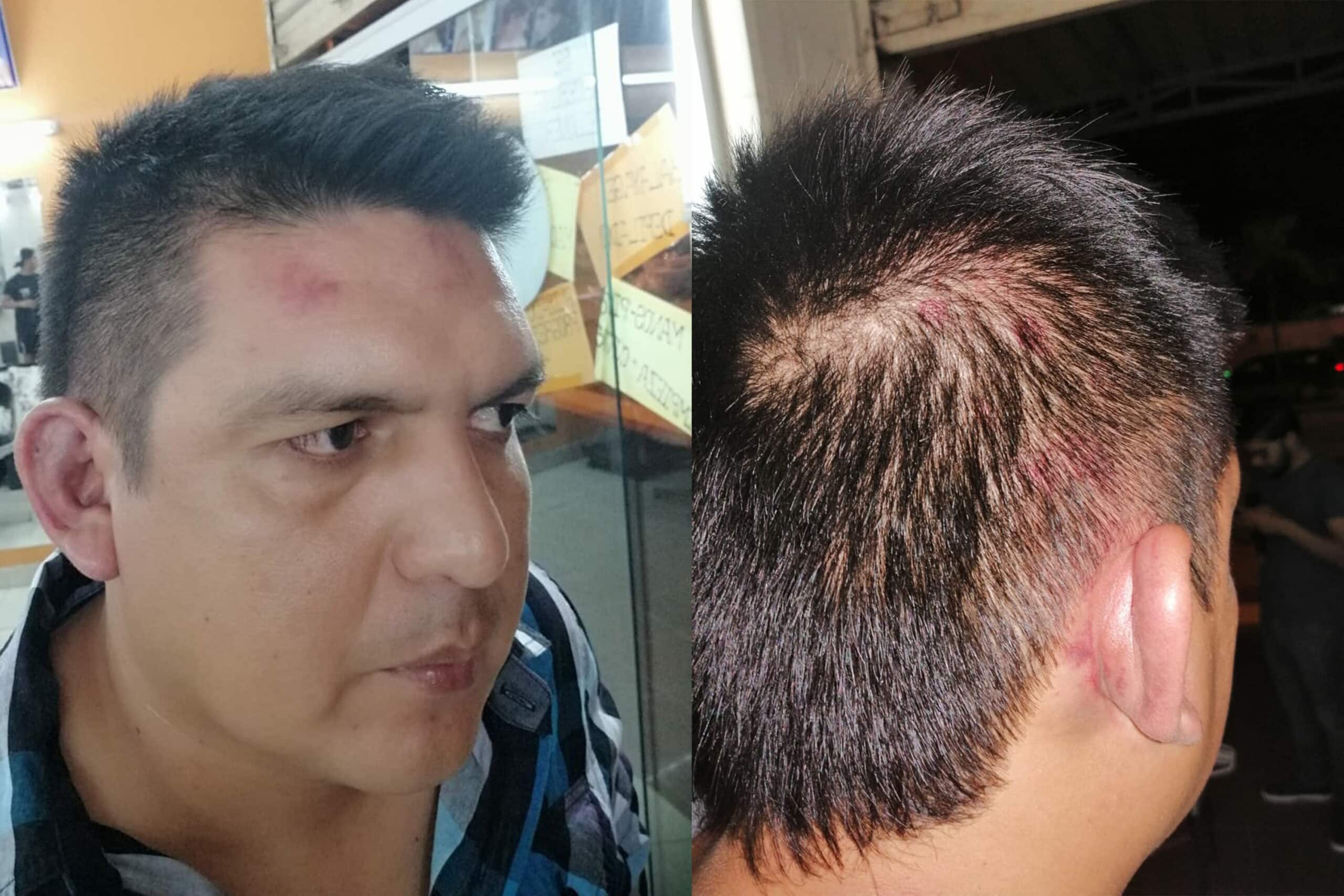 Periodista deportivo boliviano fue agredido﻿