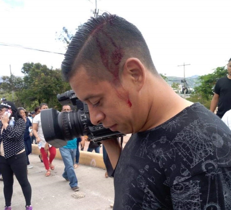 Policías agreden a camarógrafo mientras cubría manifestación de Salud y Educación